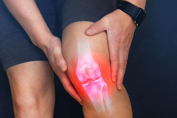 Bone Health Month